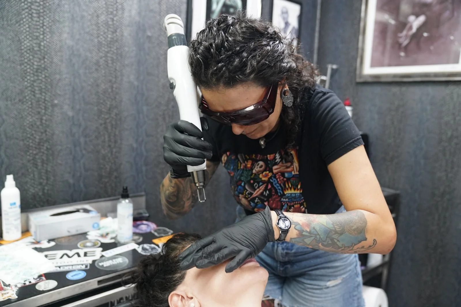 Îndepărtarea tatuajelor cu laserul: cum funcționează și ce să aștepți